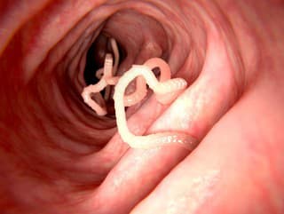 Čo o „čistení od