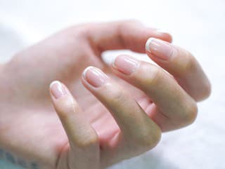 Slabé nechty nie sú