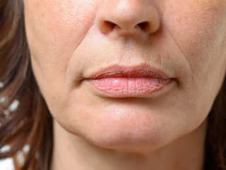 Ako prirodzene zjemniť vrásky