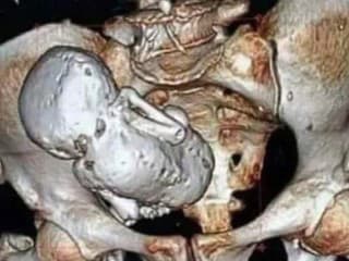 Žena skončila s bolesťou