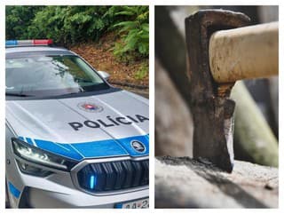 Polícia obvinila 47-ročného muža