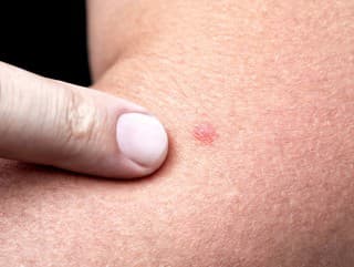 POZOR na tieto prejavy,