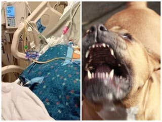 Krvavý útok pitbulla: Dohrýzol