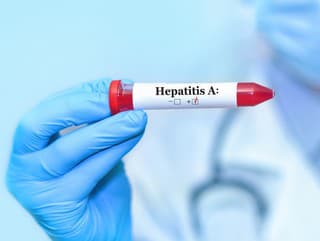 V Leviciach sa vírusová