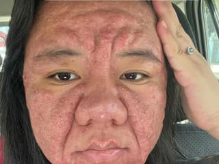 Tehotenstvo jej úplne zmenilo