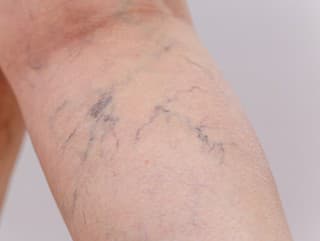 Tieto potraviny zaraďte do