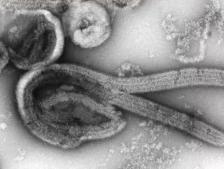 Vírus zabijak sa opäť