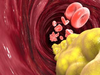 Už žiadne lieky proti