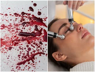 Ženy si natierajú tvár