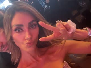 Desivý výzor známej speváčky: