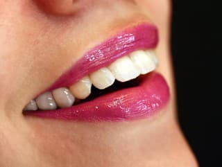 Tento NEČAKANÝ faktor vám