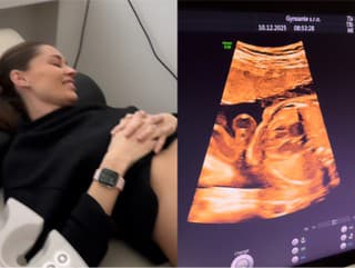 Partnerka slovenského futbalistu je