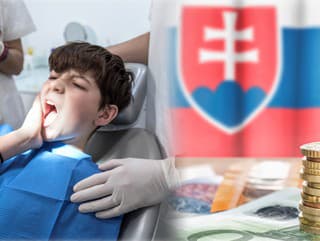 Zuby sú postrachom Slovákov: