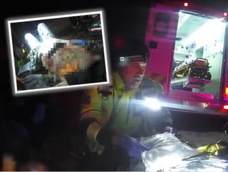 Petarda amputovala mužovi ruky: