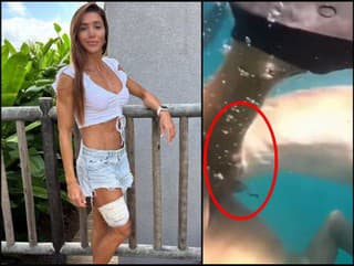 Na Turistku zaútočil žralok.