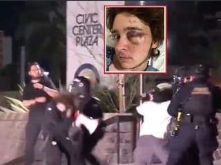 Demonštranta v Kalifornii zasiahol