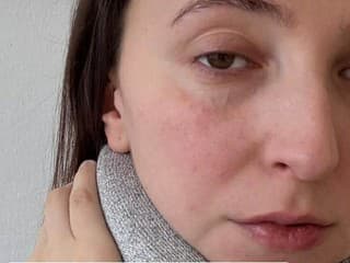 Komičke stratila úsmev: Bojuje