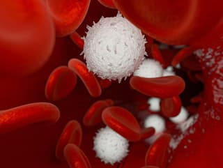 Ako bez lekárskych vyšetrení