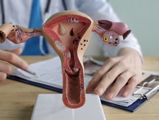 Hrozivá správa! Mrzačením pohlavných