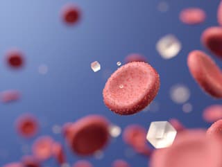 Takto znížite hladinu cukru