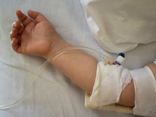 Zlomené nohy, ruky aj