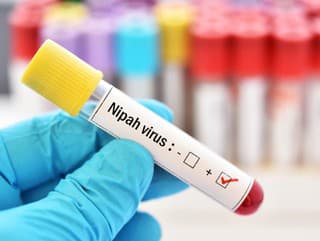 Vírus Nipah má už