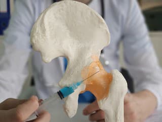 Koxartróza je extrémne častá: