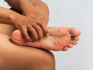 Šúpe sa vám koža