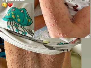 Syna vdovy po Patrikovi