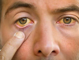 Vypil TRI litre VODKY