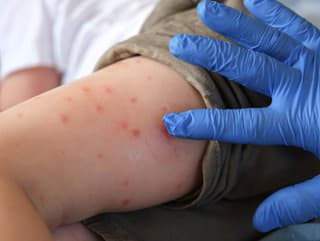 Desivé varovanie z Česka: