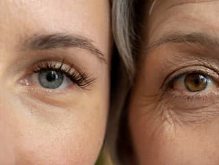 Starnutie NIE JE lineárne!