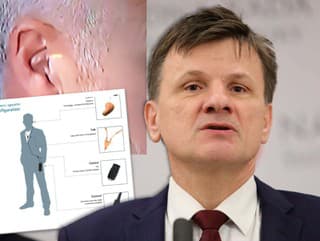 Celé Slovensko RIEŠI uši