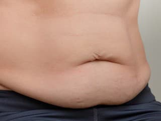 Najčastejšie omyly pri redukcii