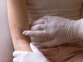 Každý deň musí vysávať