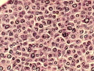 Vedci objavili, ako výrazne