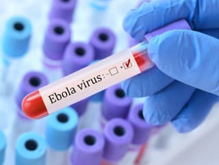 Ebola sa stále šíri: