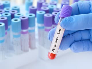 Epidémia eboly: USA presmerujú
