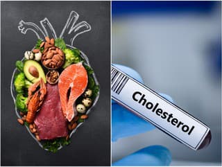 Máte vysoký cholesterol? Lekár