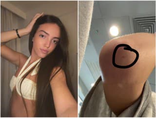 Kacey mal niekto pichnúť