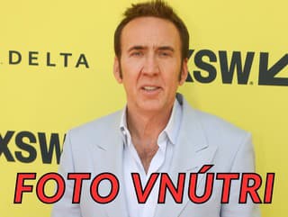 Nicolase Cage brutálne zostarol: