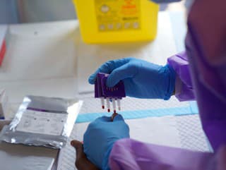 Epidémia eboly v Kongu