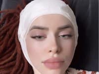 Ráchel Karnížová podstúpila ďalšiu plastiku