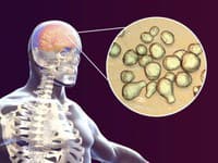 Meningitída u našich susedov! Záchranári vyšetrili 97 ľudí, dostali preventívne antibiotiká