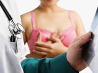 Rakovina prsníka desí milióny žien: Chirurgička odhalila šokujúce pravdy, ktoré vám lekári nepovedia