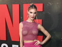 Slávna sexica sa po 12 rokoch ZBAVILA SILIKÓNOV: Intímne FOTO aj osobná spoveď... Zabíjali ma!