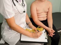Nový TEST od vedcov: Zistite, či vaše dieťa čaká obezita! Vidíte tieto prejavy už teraz?