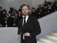 Kuriózne priznanie hollywoodskej hviezdy: Zranenie počas orgií!