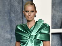 PRIZNANIE slávnej Češky zahraničným médiám: Pribrala 14 kíl... Kvôli CHOROBE!