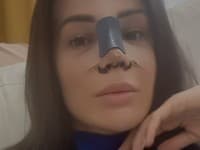 PLASTIKA známej krásky: Opísala DETAILY a... Toľkoto ju to stálo!